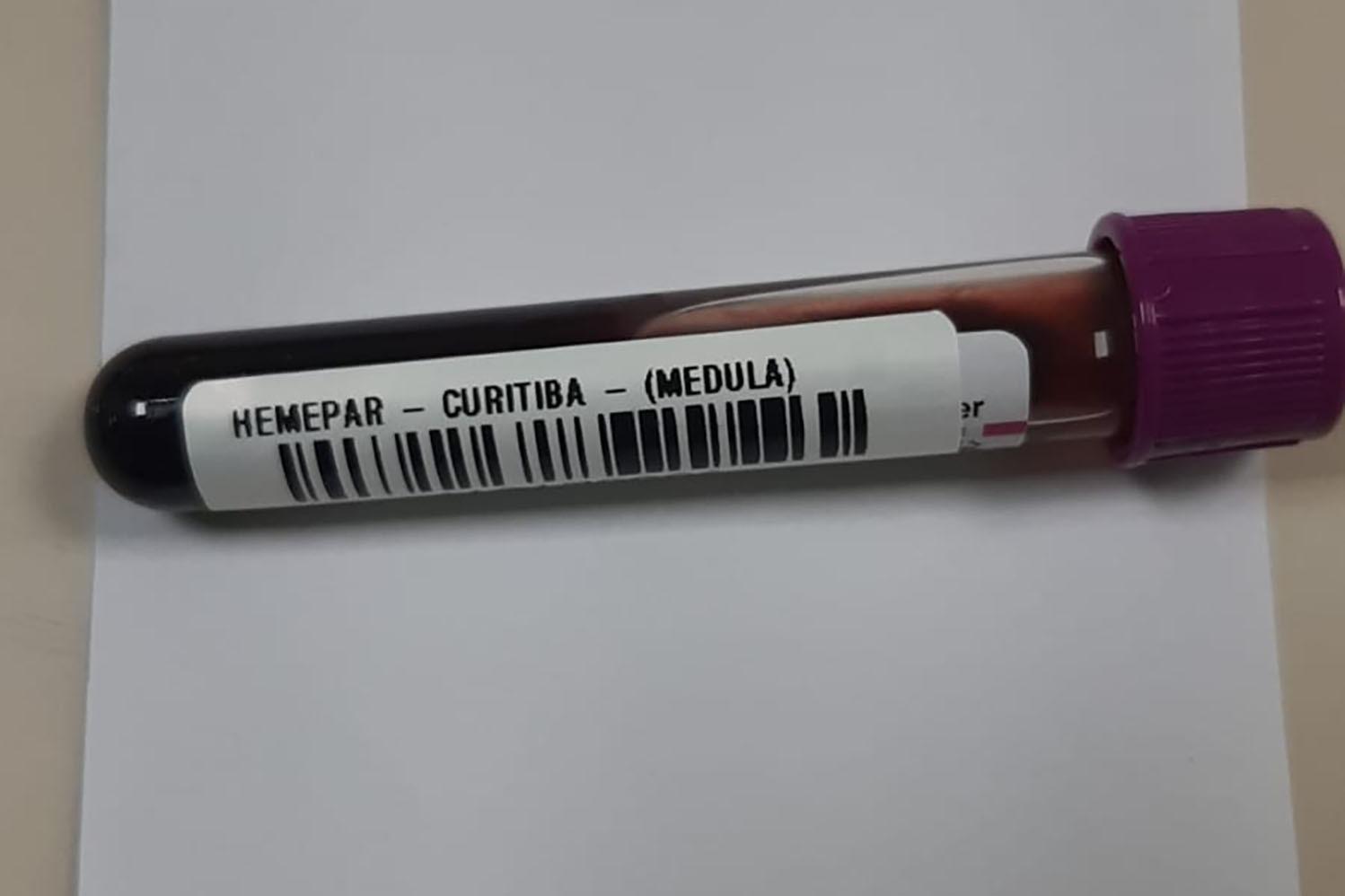 Campanha alerta para diagnóstico precoce da leucemia