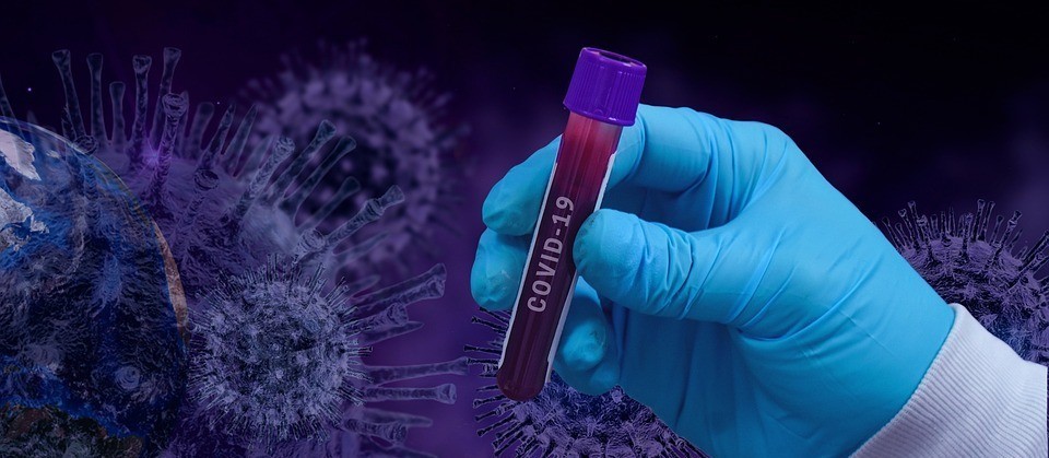 Confira os dados da Covid-19 desta sexta-feira (17) em Maringá