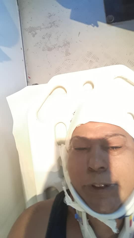 ‘É preciso expor a violência doméstica’, diz mulher agredida pelo marido