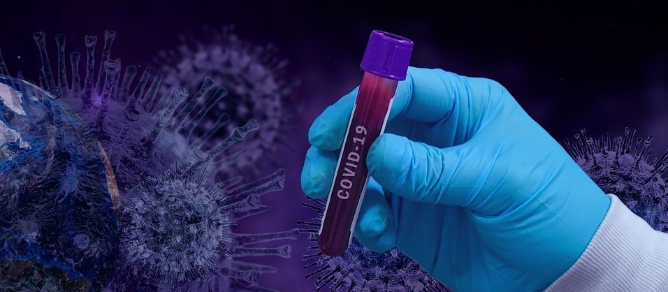 Confira o boletim atualizado sobre a Covid-19 desta sexta-feira (3)