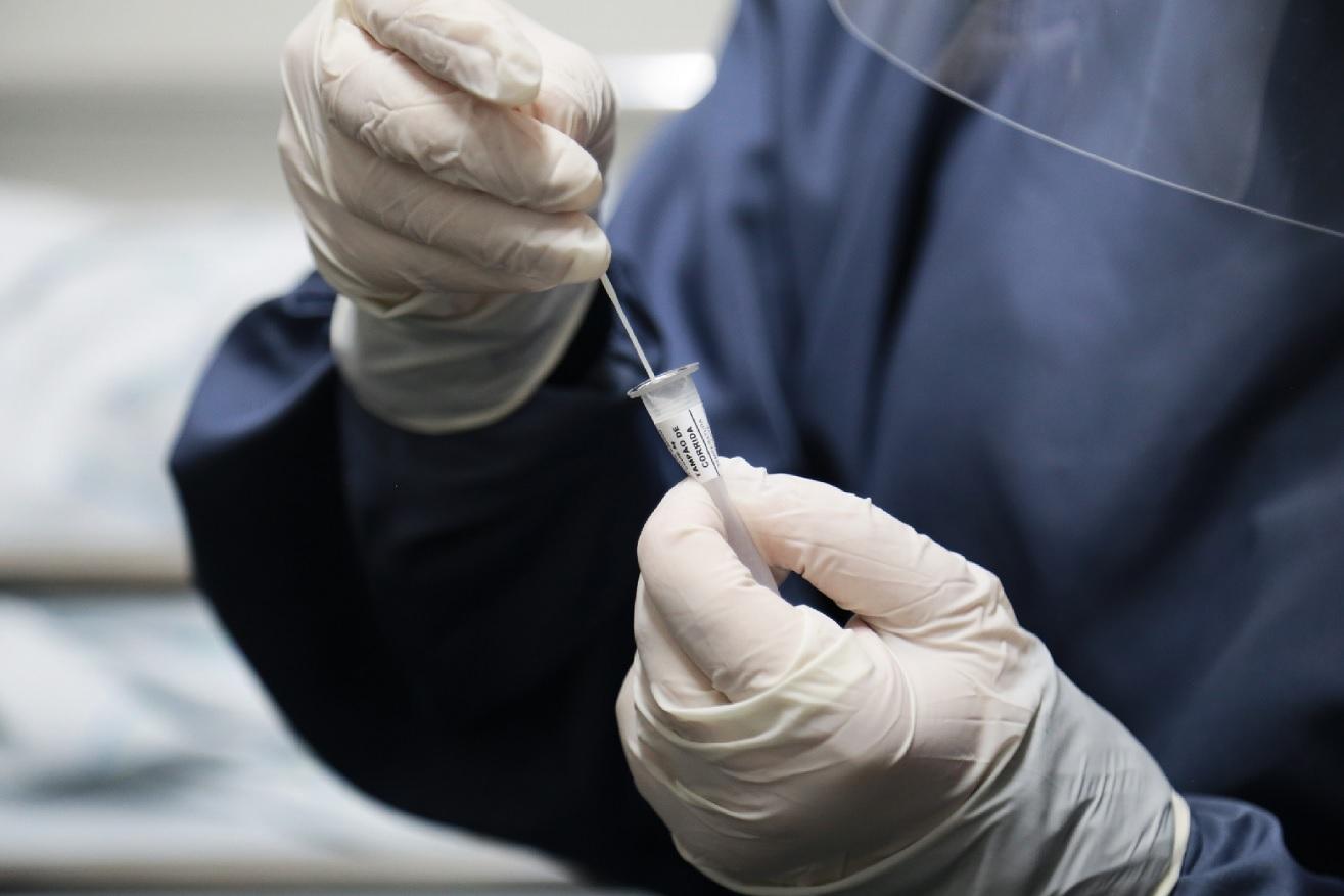 Sesa recebe nesta quinta-feira (10) testes rápidos para detectar SRAG