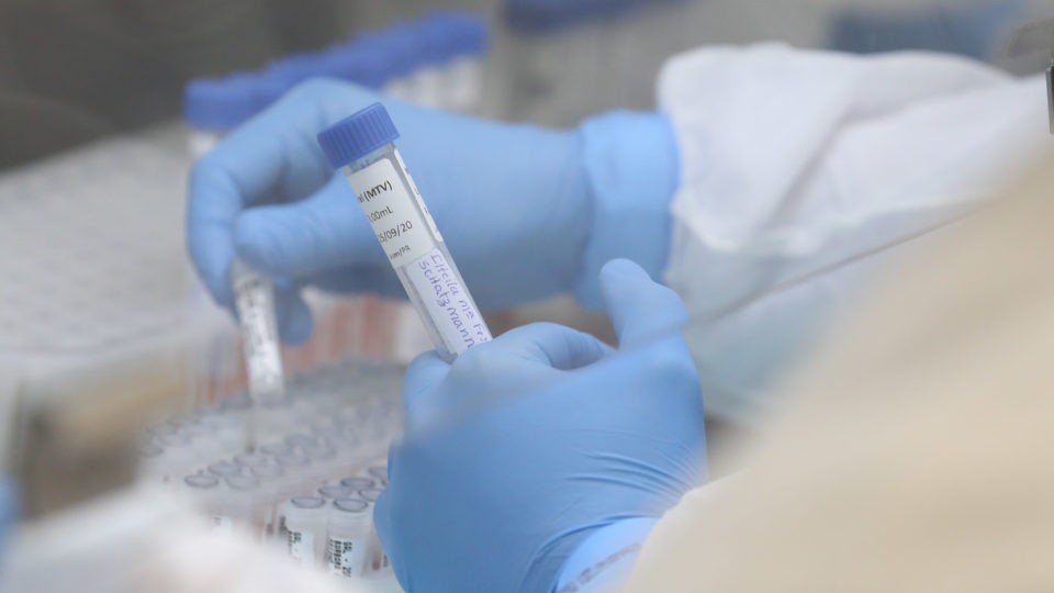 Ômicron chegou ao Paraná 20 dias depois da descoberta da variante no mundo