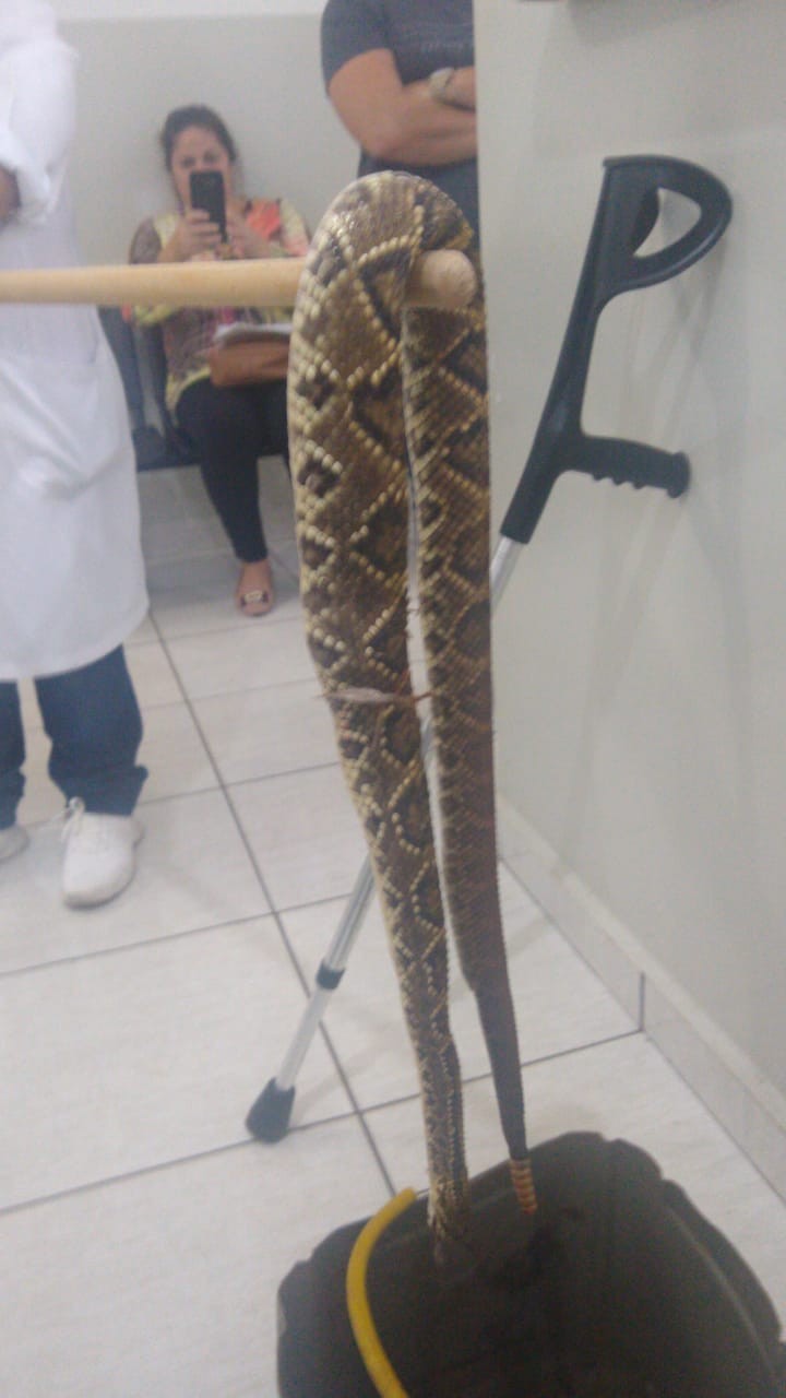 Homem fica ferido ao ser picado por cascavel na região