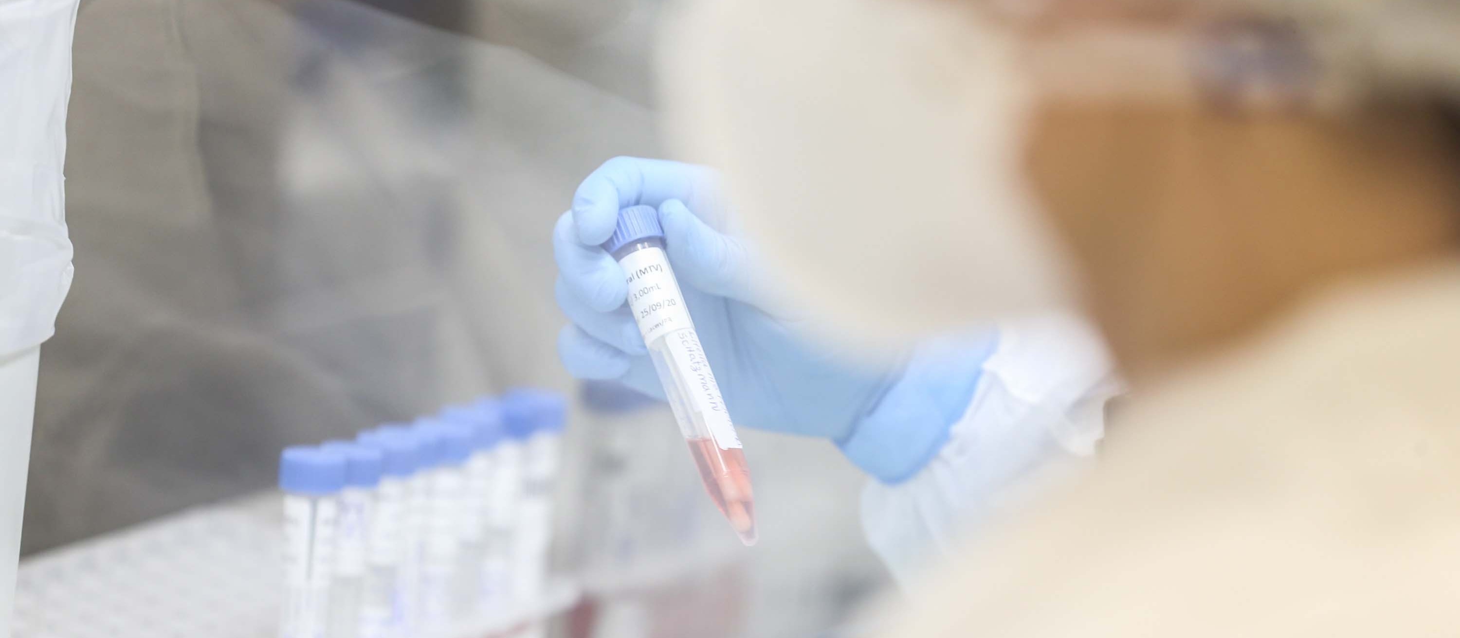 Sesa confirma 224 novos casos de Influenza H3N2
