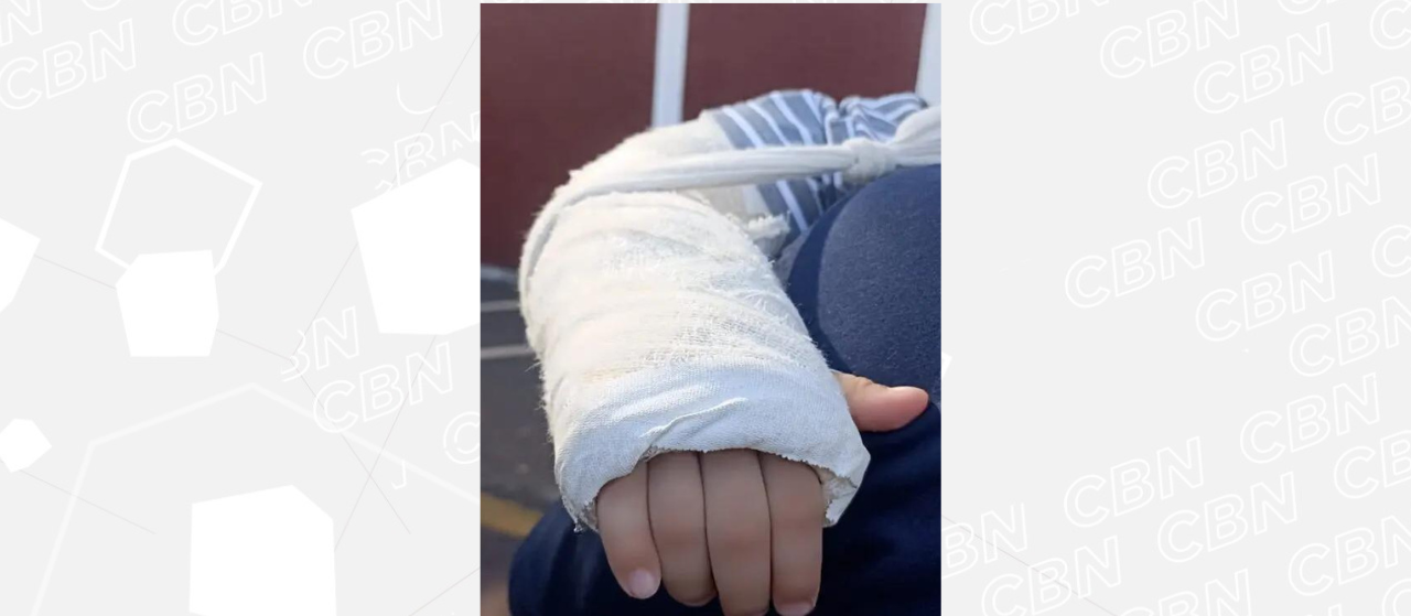 Criança volta de CMEI com braço quebrado e pais registram queixa