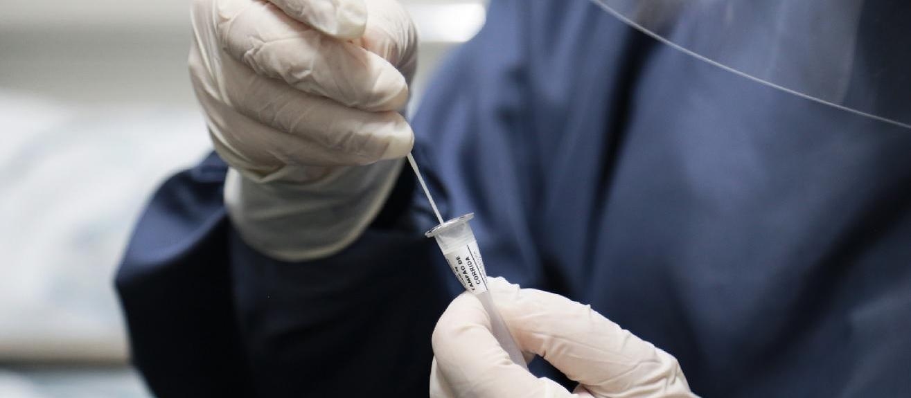 Sesa recebe nesta quinta-feira (10) testes rápidos para detectar SRAG