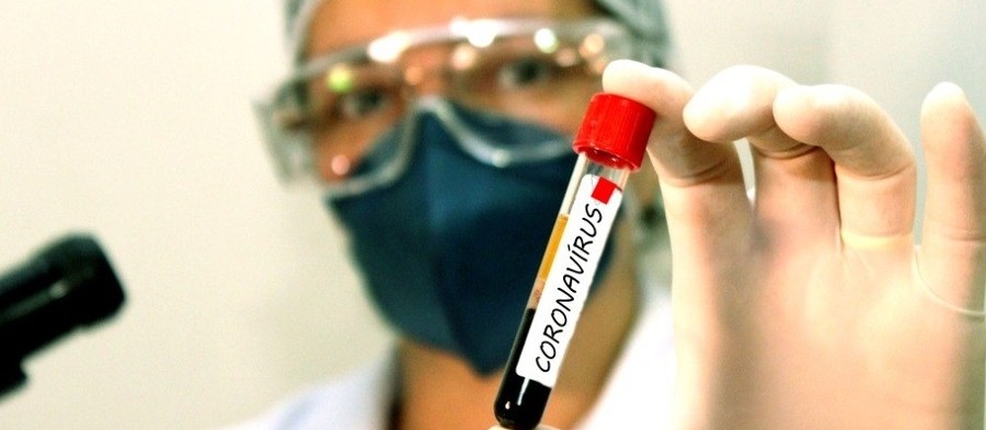 Coronavírus: confira os dados do boletim desta segunda-feira (28) em Maringá 