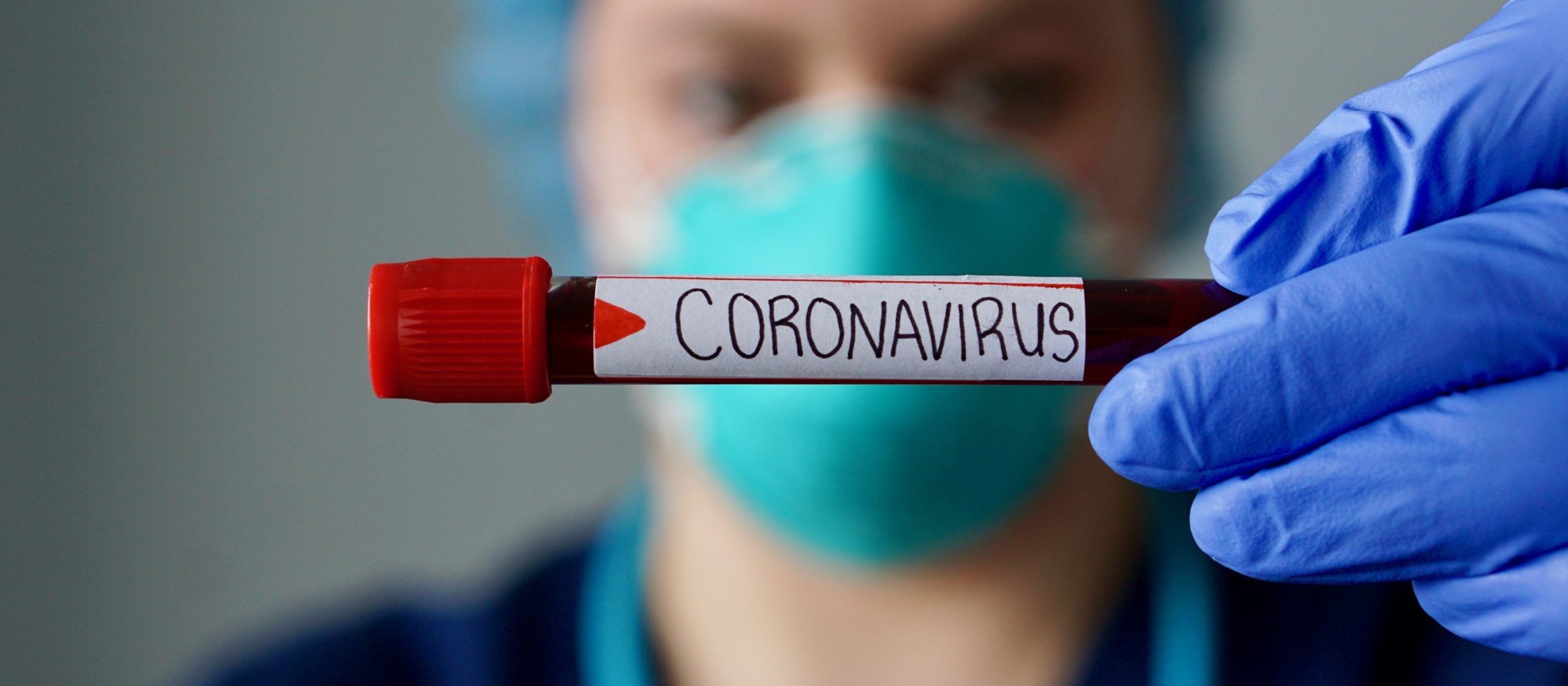 Maringá: 10 crianças estão internadas com suspeita de coronavírus
