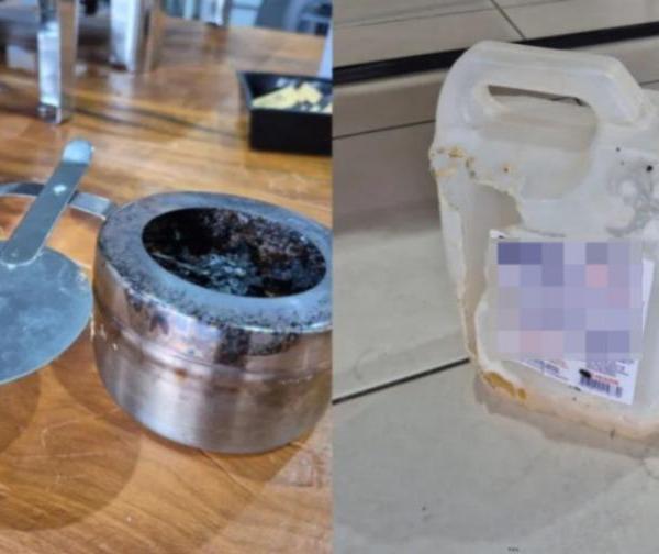 Jovem vítima de queimaduras é transferida para Londrina