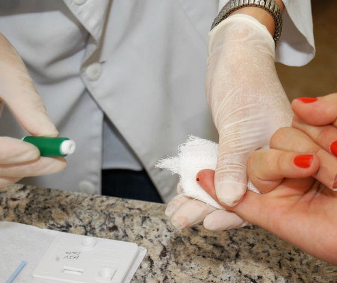 Em surto, Curitiba registra 150 casos de Hepatite A em 2024