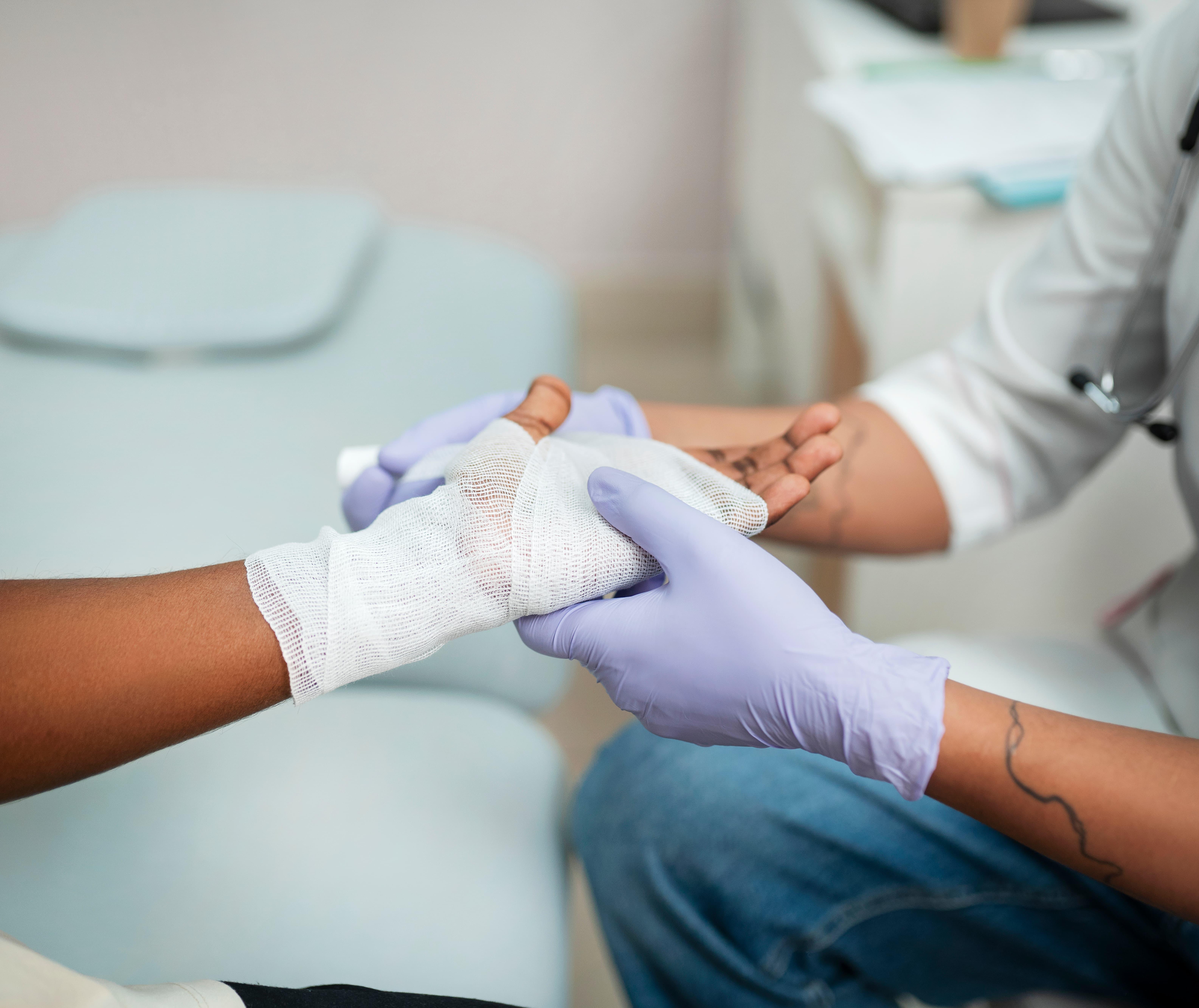 Paraná registra mais de oito mil casos de queimaduras no ano