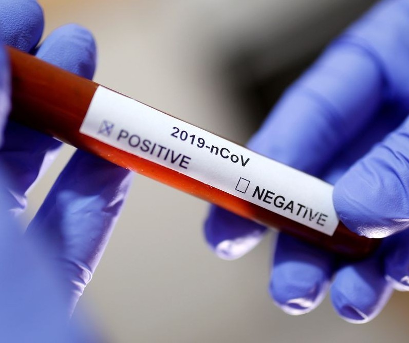 Sarandi registra primeiro caso positivo de coronavírus