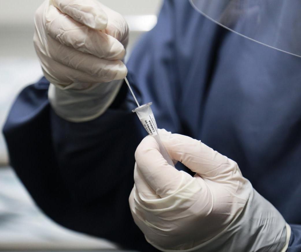 Sesa recebe nesta quinta-feira (10) testes rápidos para detectar SRAG